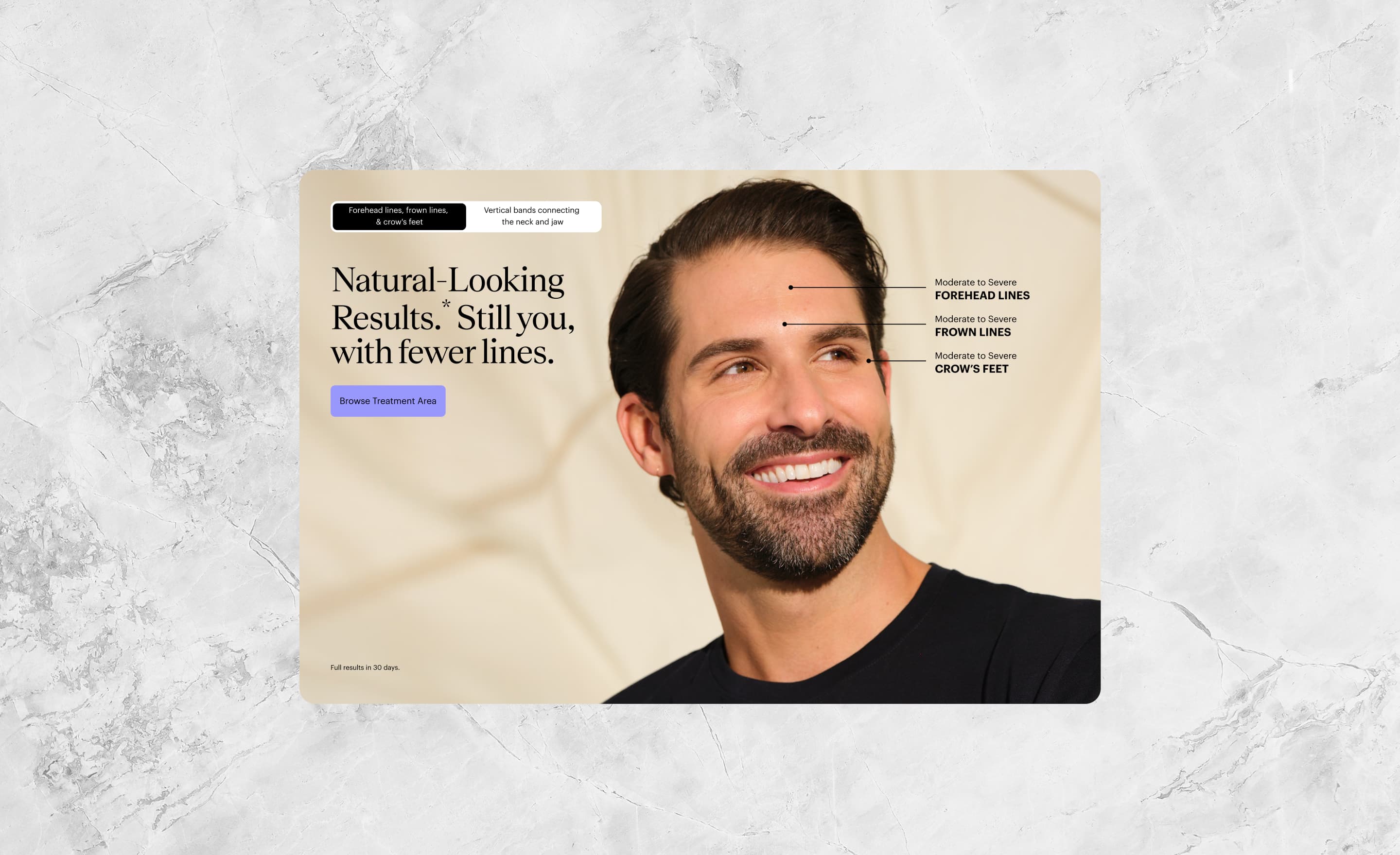 BOTOX Cosmetic Website