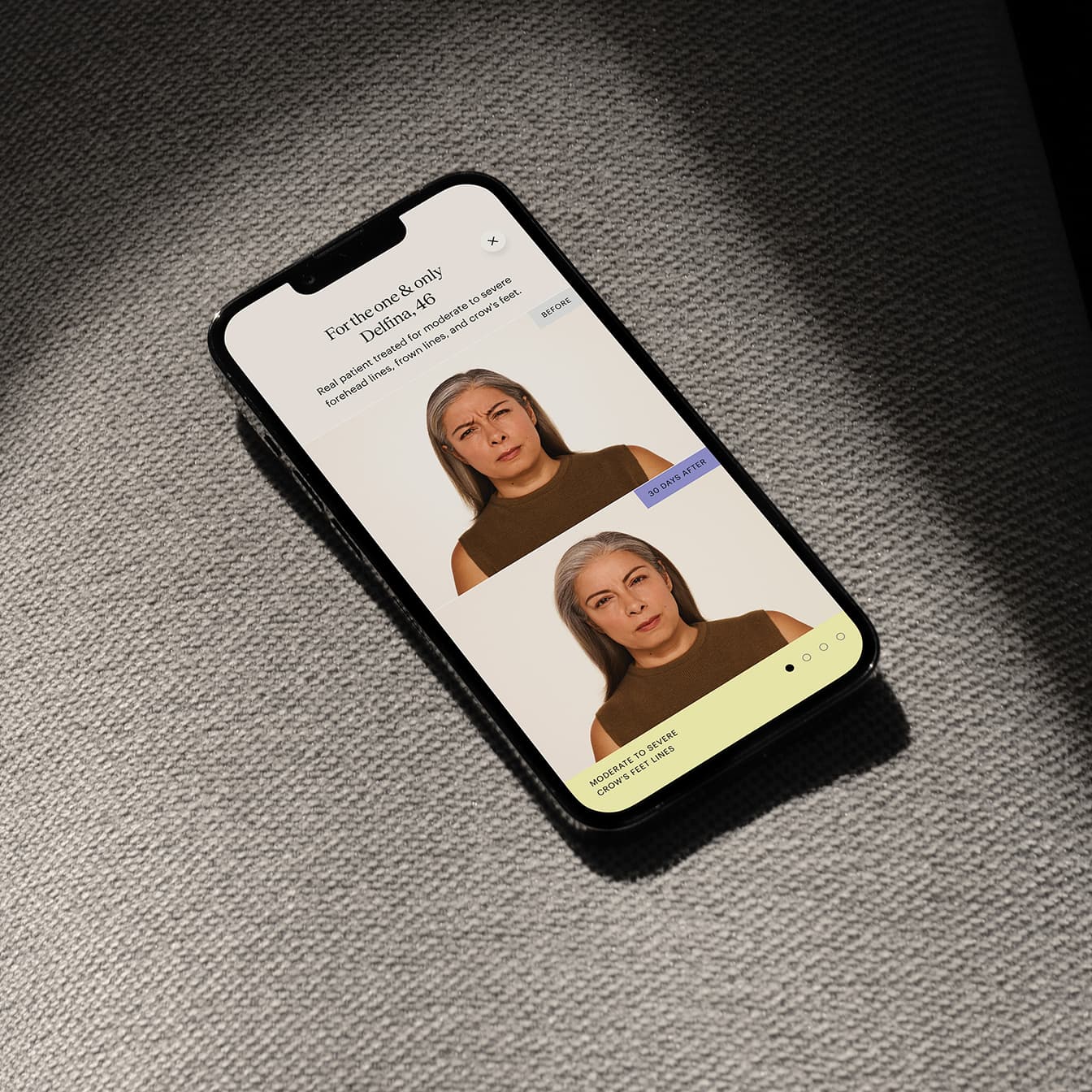 BOTOX Content Strategy